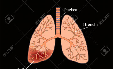 Pneumonia Backgrounds